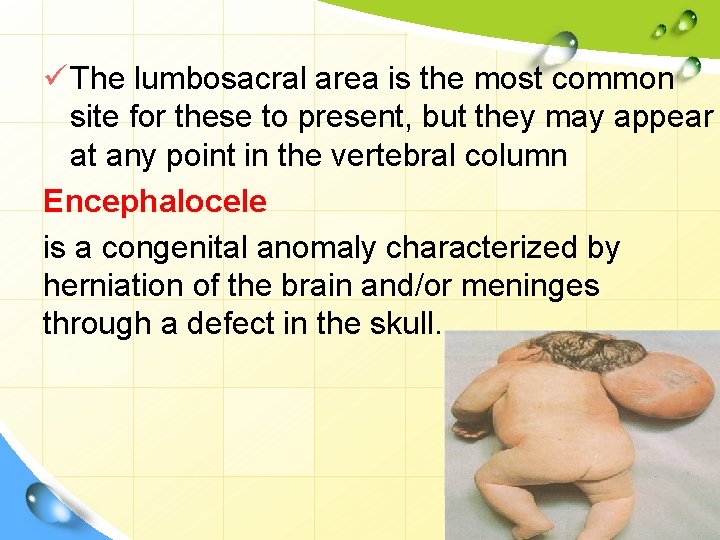 ü The lumbosacral area is the most common site for these to present, but