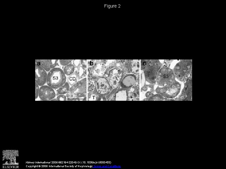 Figure 2 Kidney International 2006 692194 -2204 DOI: (10. 1038/sj. ki. 5000433) Copyright ©