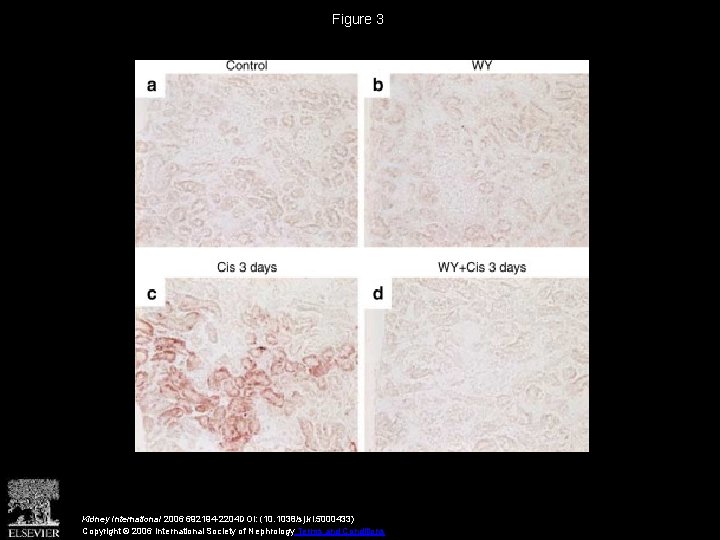 Figure 3 Kidney International 2006 692194 -2204 DOI: (10. 1038/sj. ki. 5000433) Copyright ©