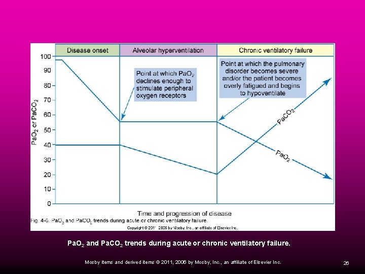 Pa. O 2 and Pa. CO 2 trends during acute or chronic ventilatory failure.