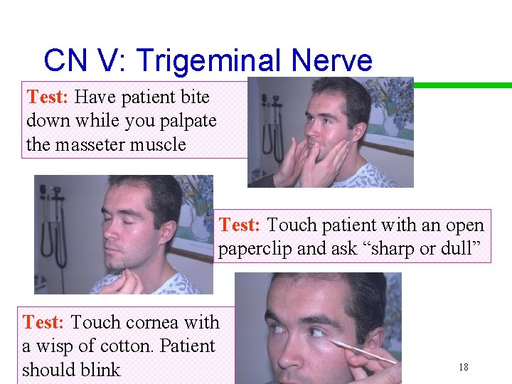 CN V: Trigeminal Nerve Test: Have patient bite down while you palpate the masseter