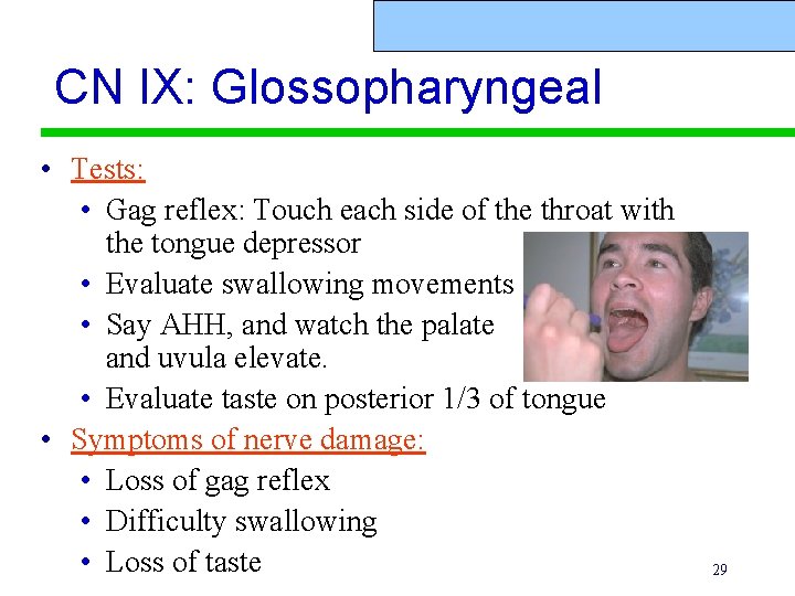 CN IX: Glossopharyngeal • Tests: • Gag reflex: Touch each side of the throat