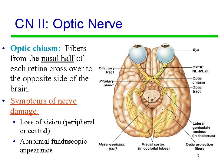 CN II: Optic Nerve • Optic chiasm: Fibers from the nasal half of each