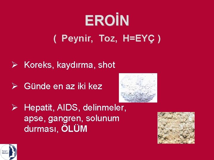 EROİN ( Peynir, Toz, H=EYÇ ) Ø Koreks, kaydırma, shot Ø Günde en az