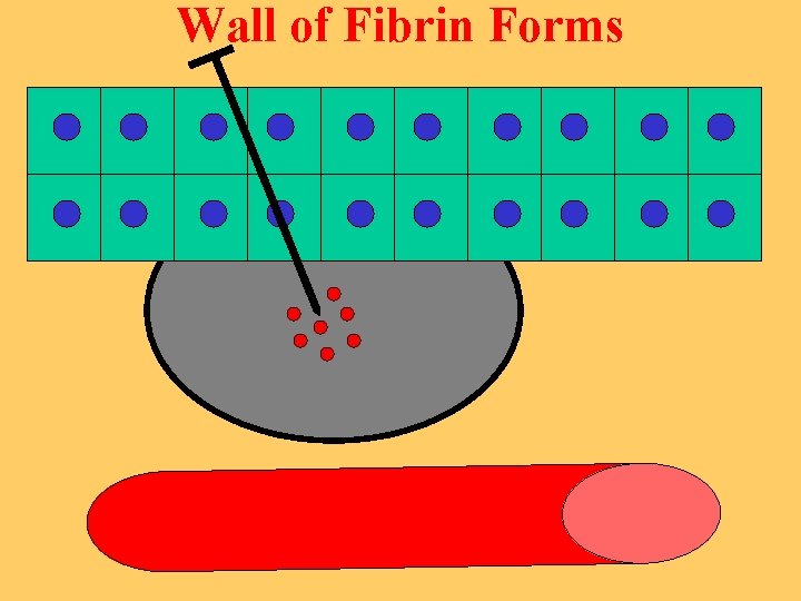 Wall of Fibrin Forms 