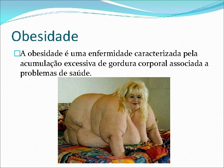 Obesidade �A obesidade é uma enfermidade caracterizada pela acumulação excessiva de gordura corporal associada