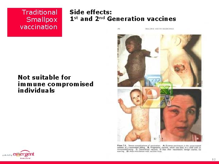 Traditional Smallpox vaccination Side effects: 1 st and 2 nd Generation vaccines Not suitable