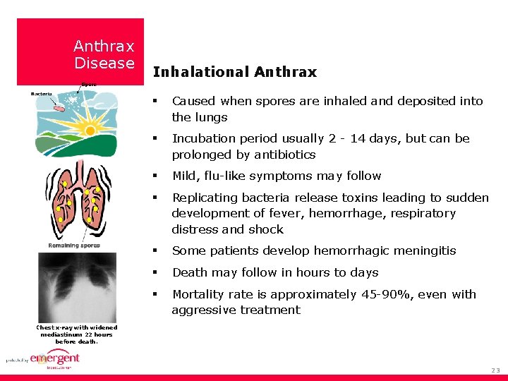 Anthrax Disease Inhalational Anthrax Caused when spores are inhaled and deposited into the lungs
