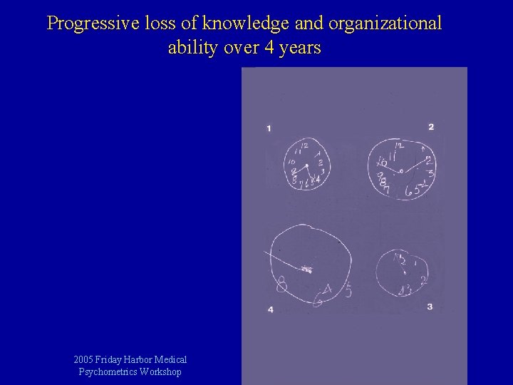 Progressive loss of knowledge and organizational ability over 4 years 2005 Friday Harbor Medical