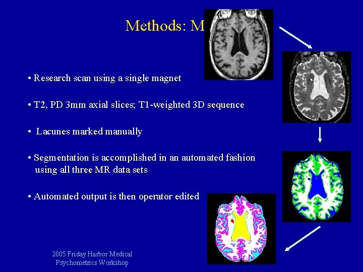 Methods: MRI • Research scan using a single magnet • T 2, PD 3