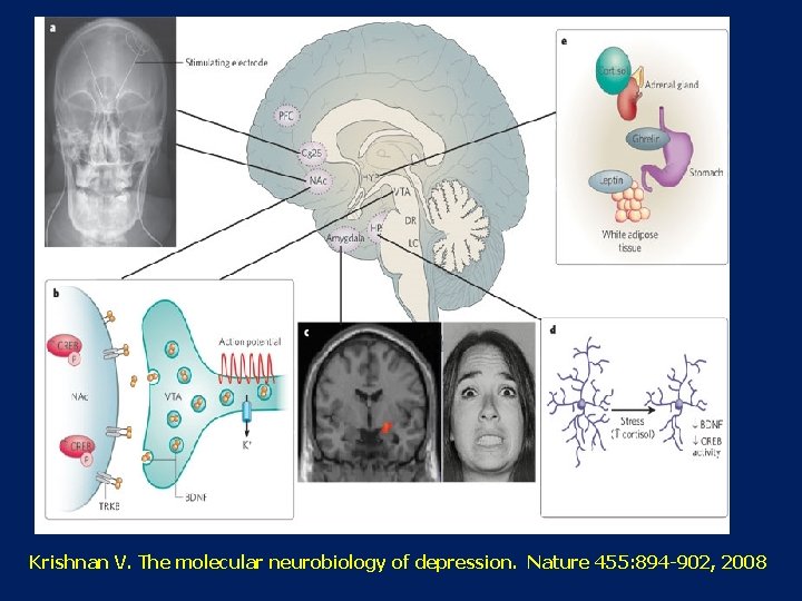 Krishnan V. The molecular neurobiology of depression. Nature 455: 894 -902, 2008 