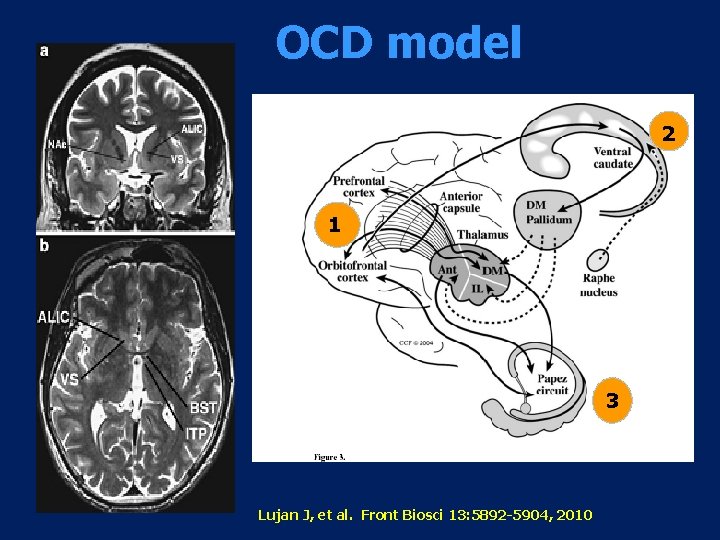 OCD model 2 1 3 Lujan J, et al. Front Biosci 13: 5892 -5904,