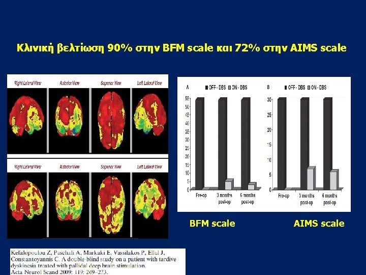 Κλινική βελτίωση 90% στην BFM scale και 72% στην ΑΙMS scale BFM scale AIMS