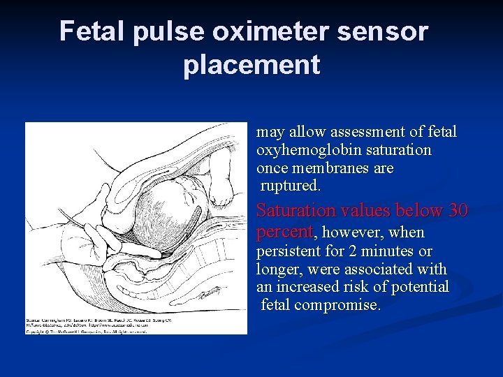 Fetal pulse oximeter sensor placement may allow assessment of fetal oxyhemoglobin saturation once membranes
