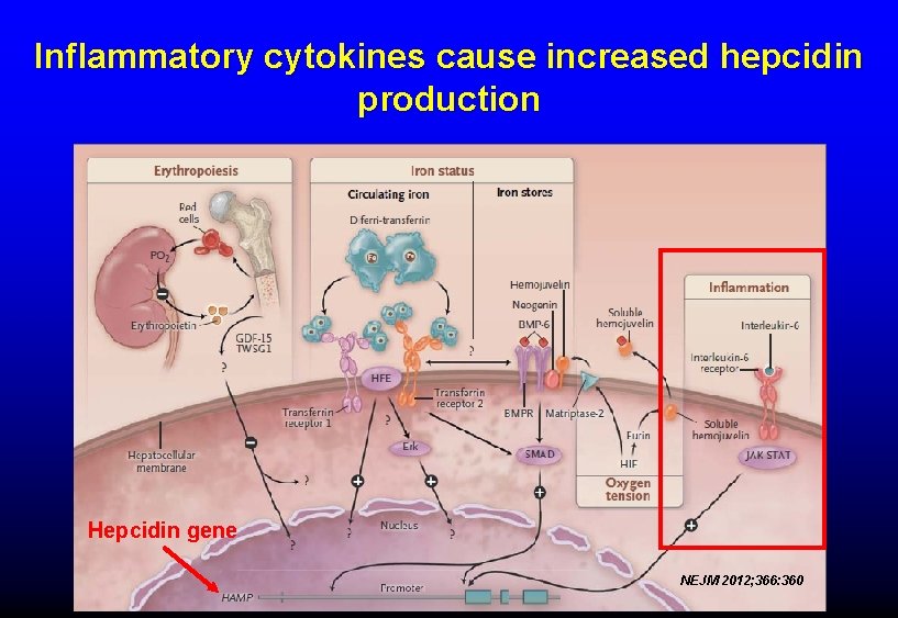Inflammatory cytokines cause increased hepcidin production Hepcidin gene NEJM 2012; 366: 360 