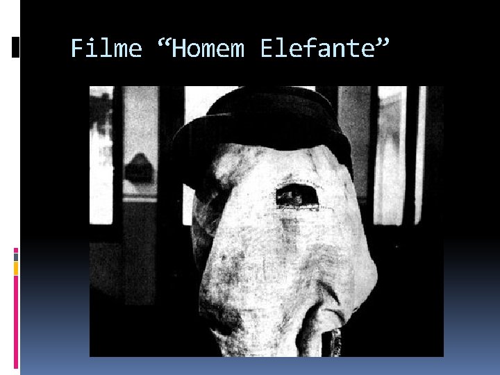 Filme “Homem Elefante” 