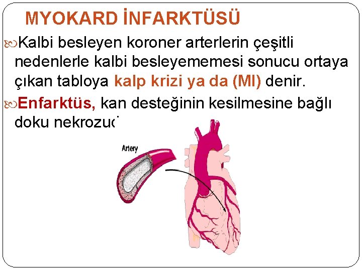MYOKARD İNFARKTÜSÜ Kalbi besleyen koroner arterlerin çeşitli nedenlerle kalbi besleyememesi sonucu ortaya çıkan tabloya