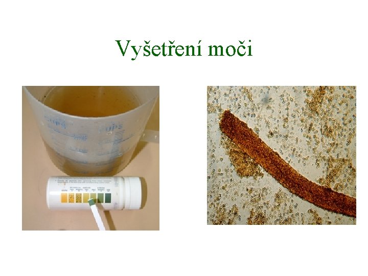 Vyšetření moči 