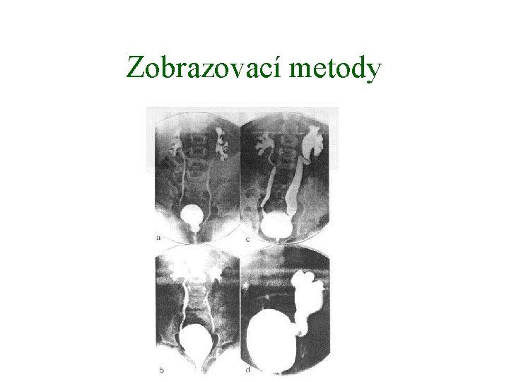 Zobrazovací metody 