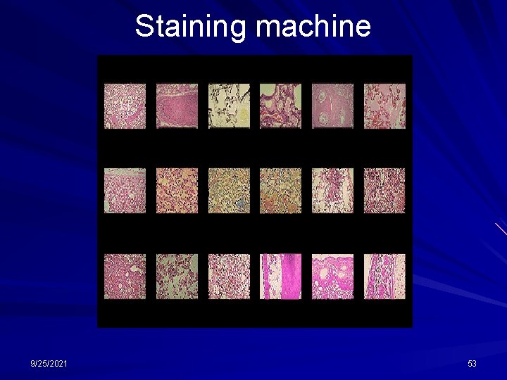 Staining machine 9/25/2021 53 