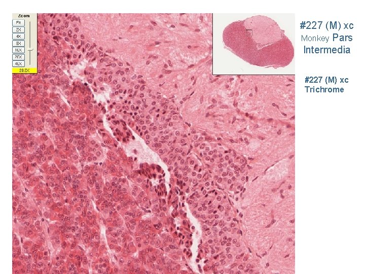 #227 (M) xc Monkey Pars Intermedia #227 (M) xc Trichrome 