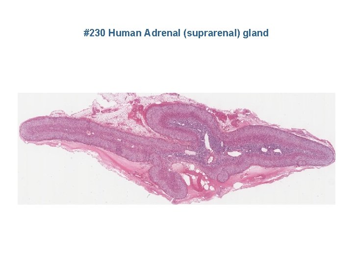 #230 Human Adrenal (suprarenal) gland 