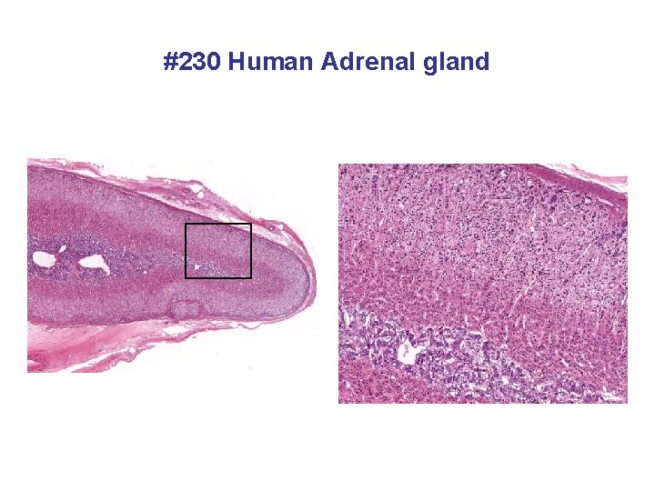 #230 Human Adrenal gland 