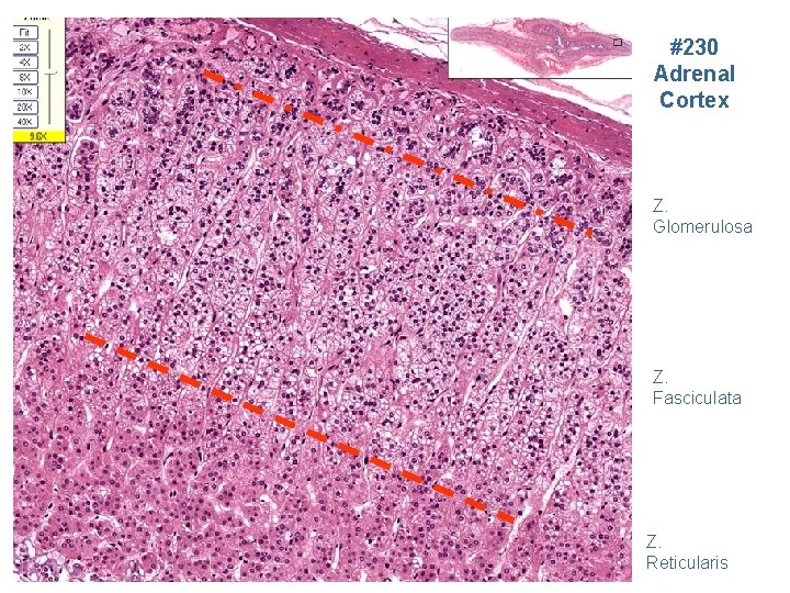 #230 Adrenal Cortex Z. Glomerulosa Z. Fasciculata Z. Reticularis 