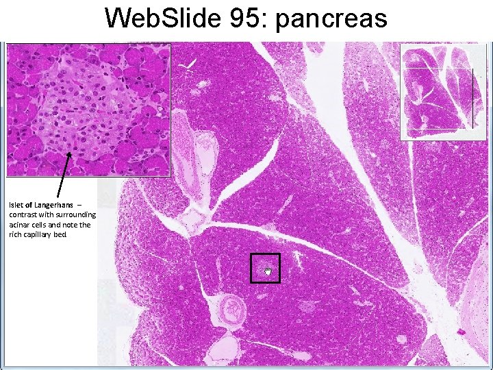 Web. Slide 95: pancreas Islet of Langerhans – contrast with surrounding acinar cells and