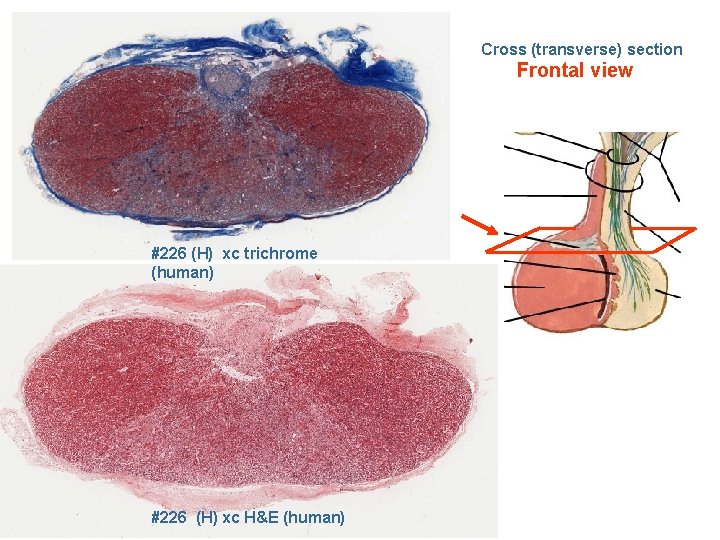 Cross (transverse) section Frontal view #226 (H) xc trichrome (human) #226 (H) xc H&E