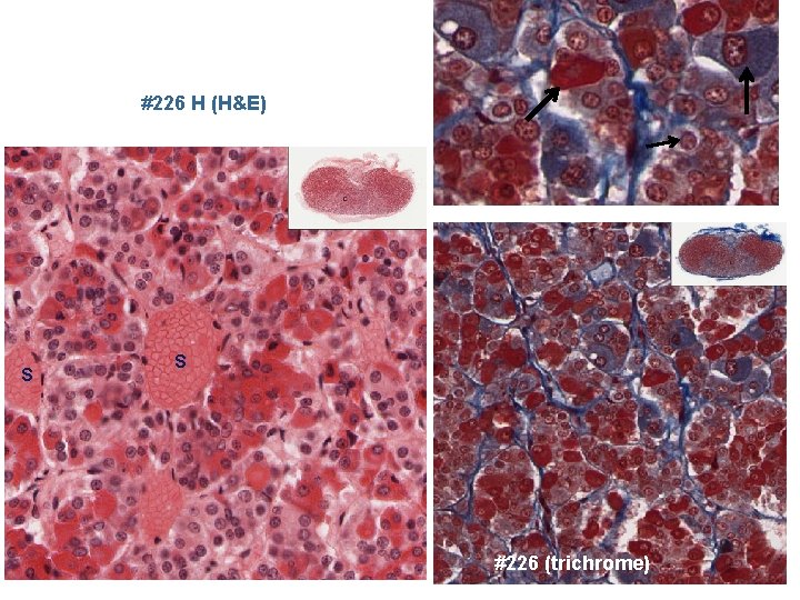 #226 H (H&E) S S #226 (trichrome) 