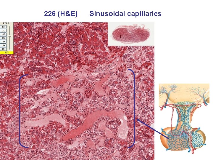 226 (H&E) Sinusoidal capillaries 