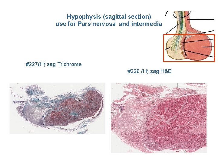 Hypophysis (sagittal section) use for Pars nervosa and intermedia #227(H) sag Trichrome #226 (H)