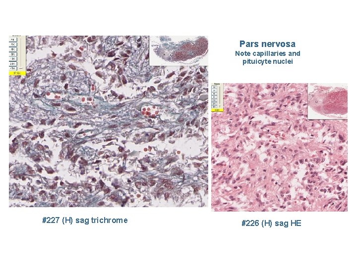 Pars nervosa Note capillaries and pituicyte nuclei #227 (H) sag trichrome #226 (H) sag