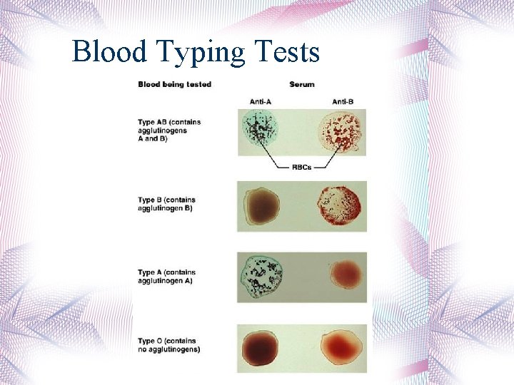 Blood Typing Tests 