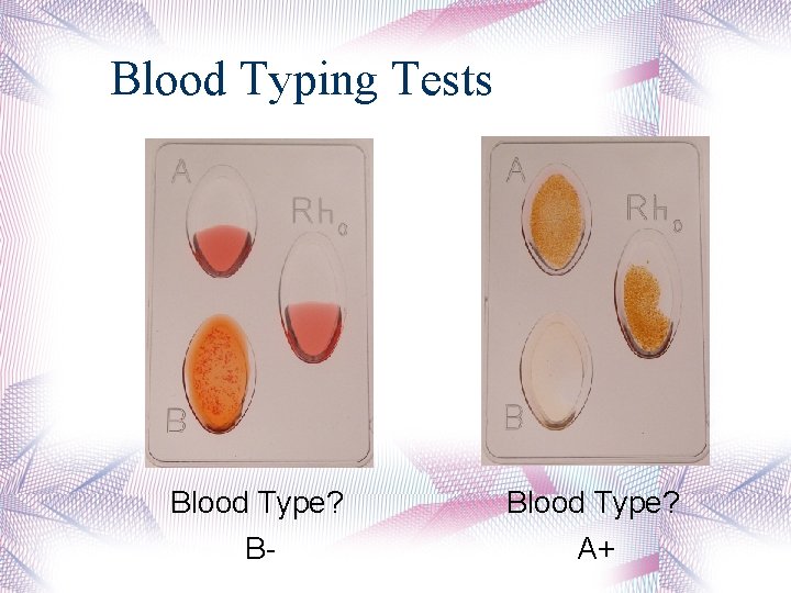 Blood Typing Tests Blood Type? B- Blood Type? A+ 