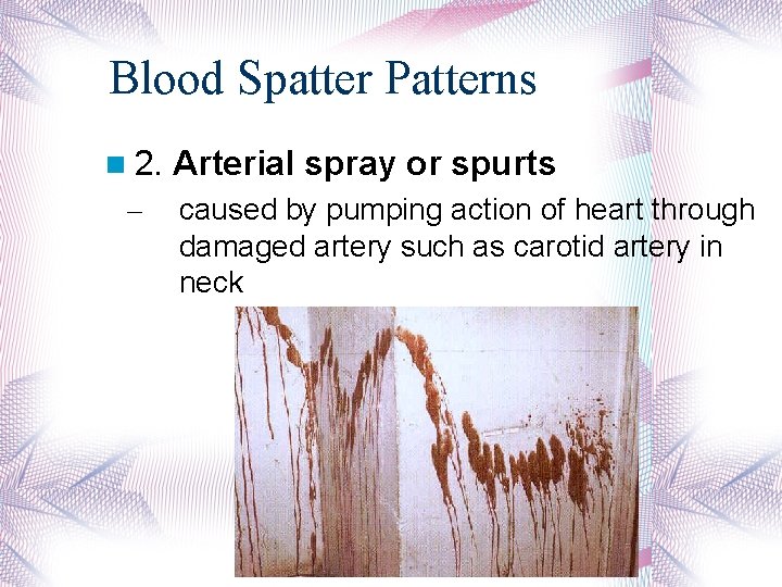 Blood Spatter Patterns 2. – Arterial spray or spurts caused by pumping action of