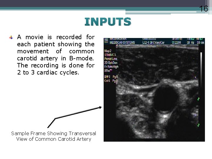 16 INPUTS A movie is recorded for each patient showing the movement of common