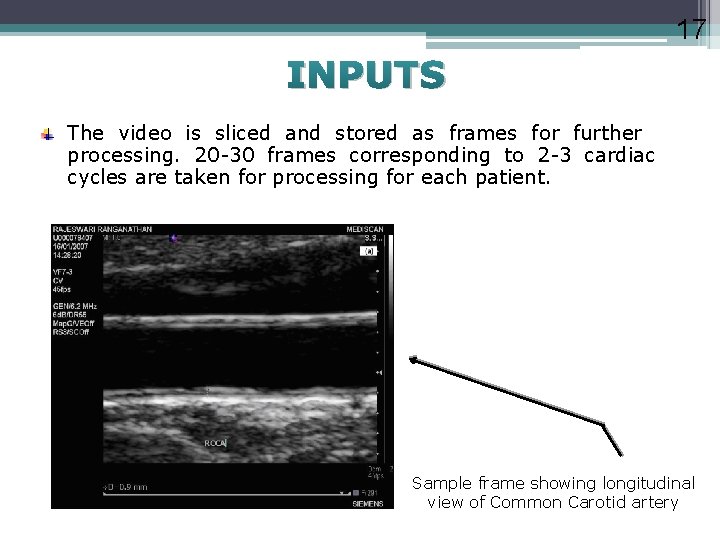 17 INPUTS The video is sliced and stored as frames for further processing. 20
