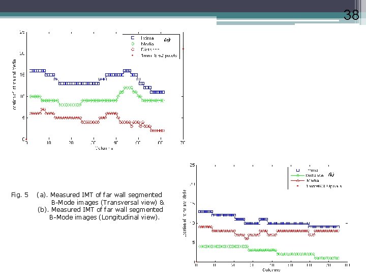38 Fig. 5 (a). Measured IMT of far wall segmented B-Mode images (Transversal view)