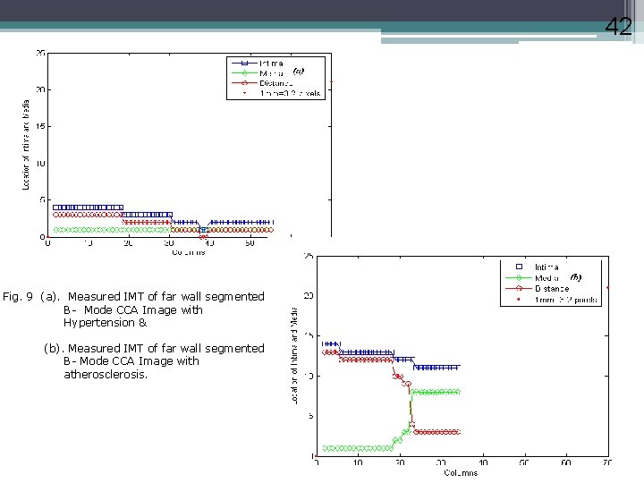 42 Fig. 9 (a). Measured IMT of far wall segmented B- Mode CCA Image
