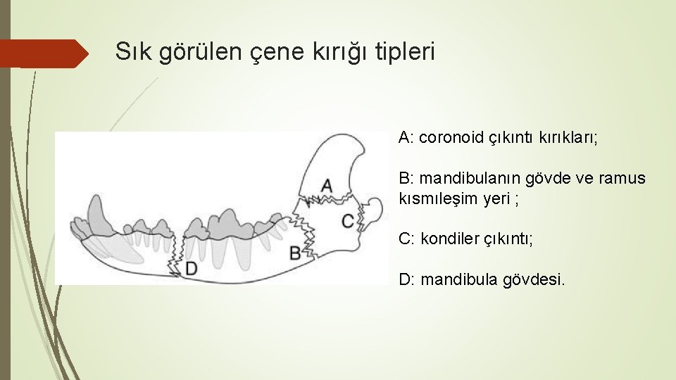 Sık görülen çene kırığı tipleri A: coronoid çıkıntı kırıkları; B: mandibulanın gövde ve ramus