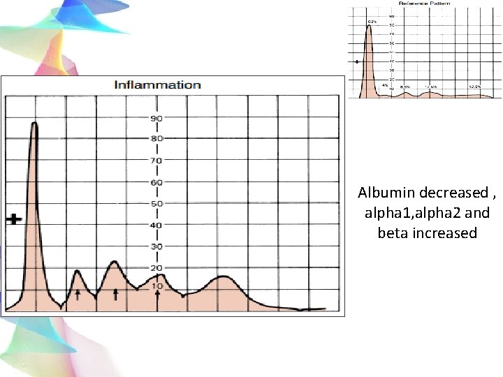 Albumin decreased , alpha 1, alpha 2 and beta increased 