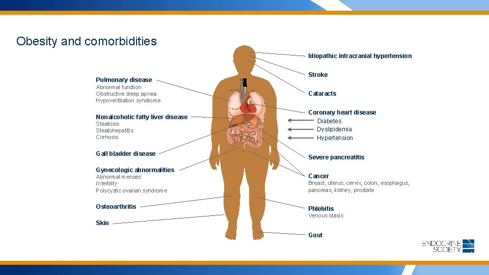 Obesity and comorbidities Idiopathic intracranial hypertension Pulmonary disease Abnormal function Obstructive sleep apnea Hypoventilation