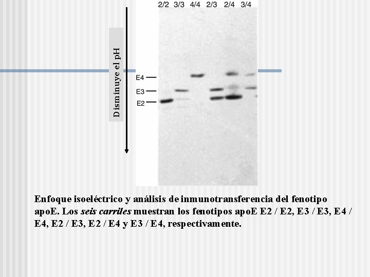 Disminuye el p. H Enfoque isoeléctrico y análisis de inmunotransferencia del fenotipo apo. E.