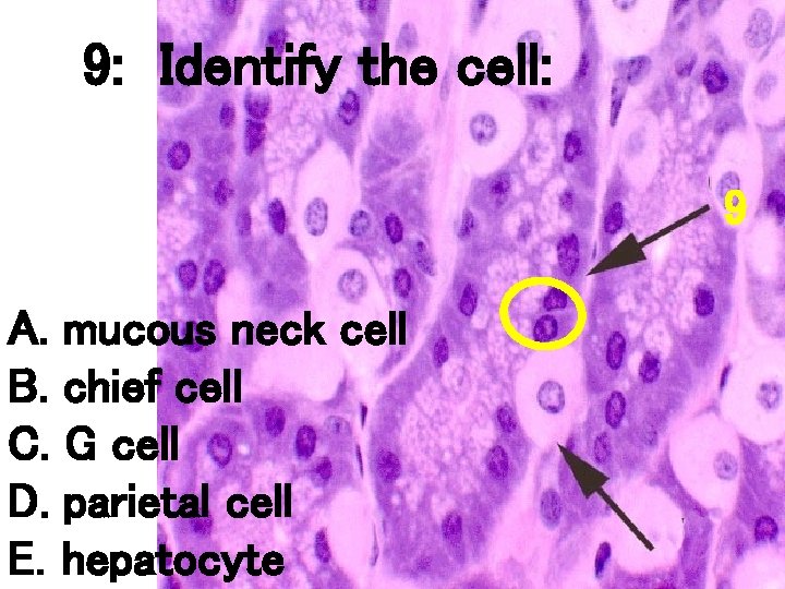 9: Identify the cell: 9 A. mucous neck cell B. chief cell C. G