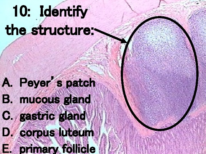 10: Identify the structure: A. B. C. D. E. Peyer’s patch mucous gland gastric