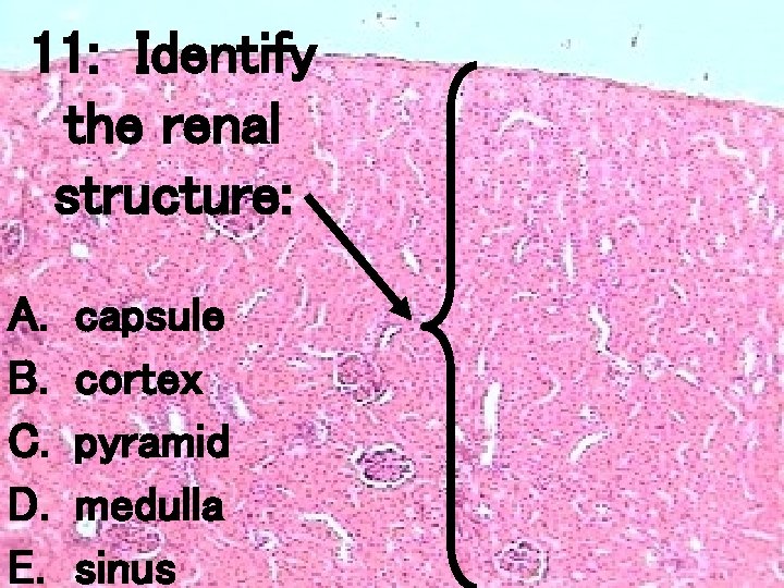 11: Identify the renal structure: A. B. C. D. E. capsule cortex pyramid medulla 11: Identify the renal structure: A. B. C. D. E. capsule cortex pyramid medulla