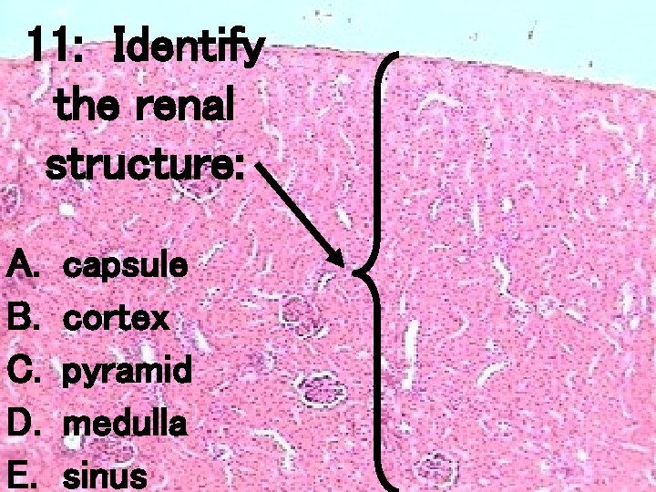 11: Identify the renal structure: A. B. C. D. E. capsule cortex pyramid medulla