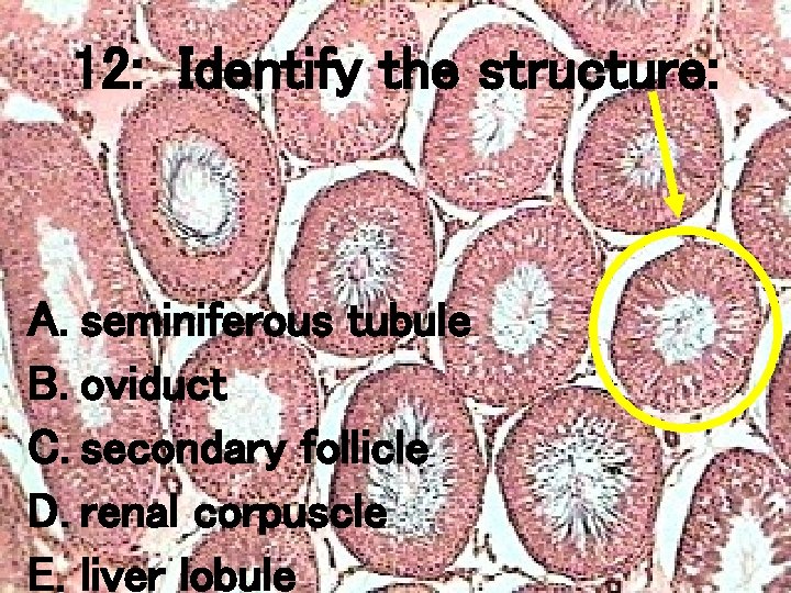 12: Identify the structure: A. seminiferous tubule B. oviduct C. secondary follicle D. renal